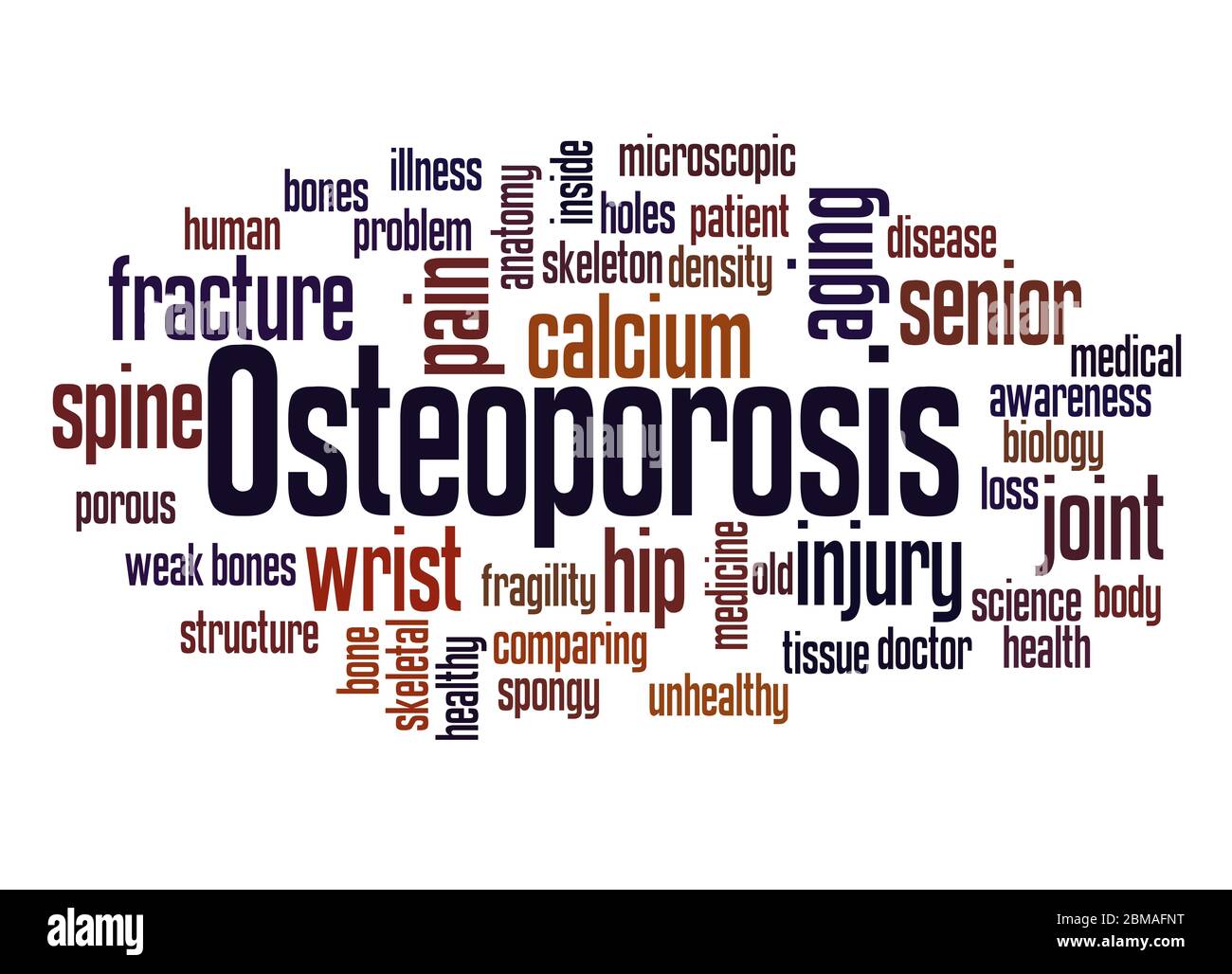 Osteoporosis word cloud concept on white background Stock Photo - Alamy