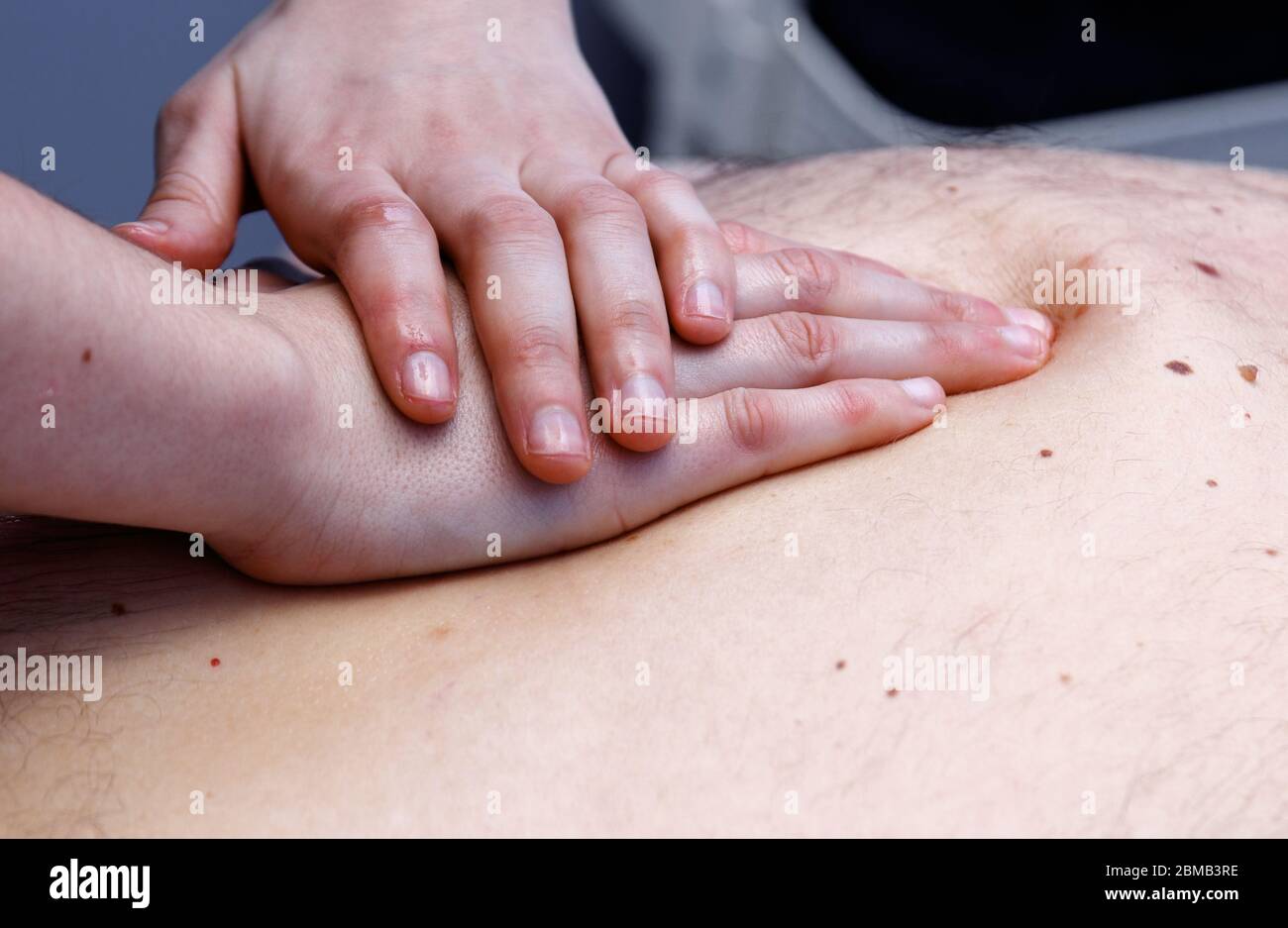 physiotherapy view in the skin Stock Photo