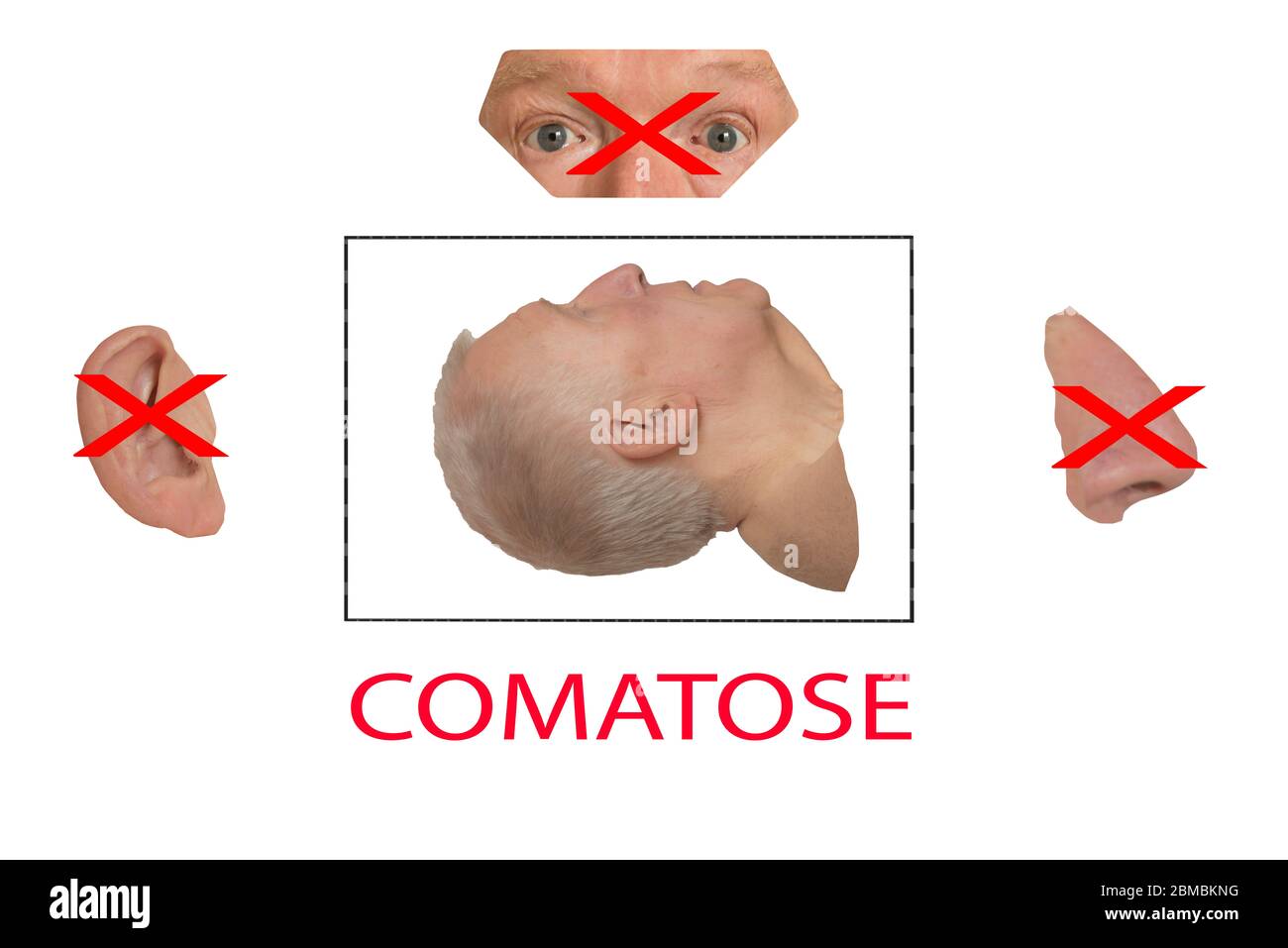 Comatose High Resolution Stock Photography And Images Alamy Comatose High Resolution Stock Photography And Images Alamy