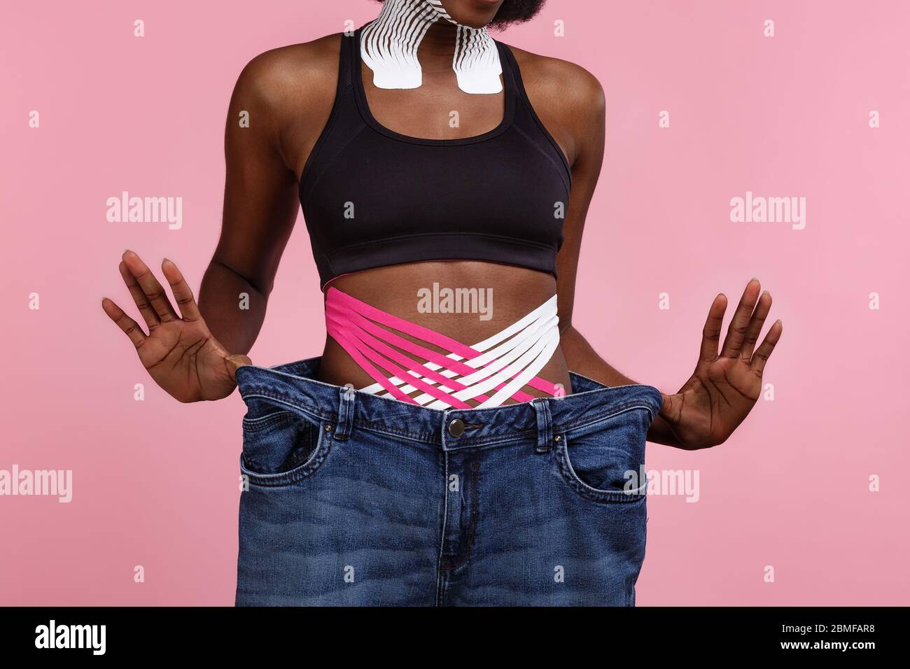 Weight loss concept. Kinesiology taping.Anti-cellulite procedure for