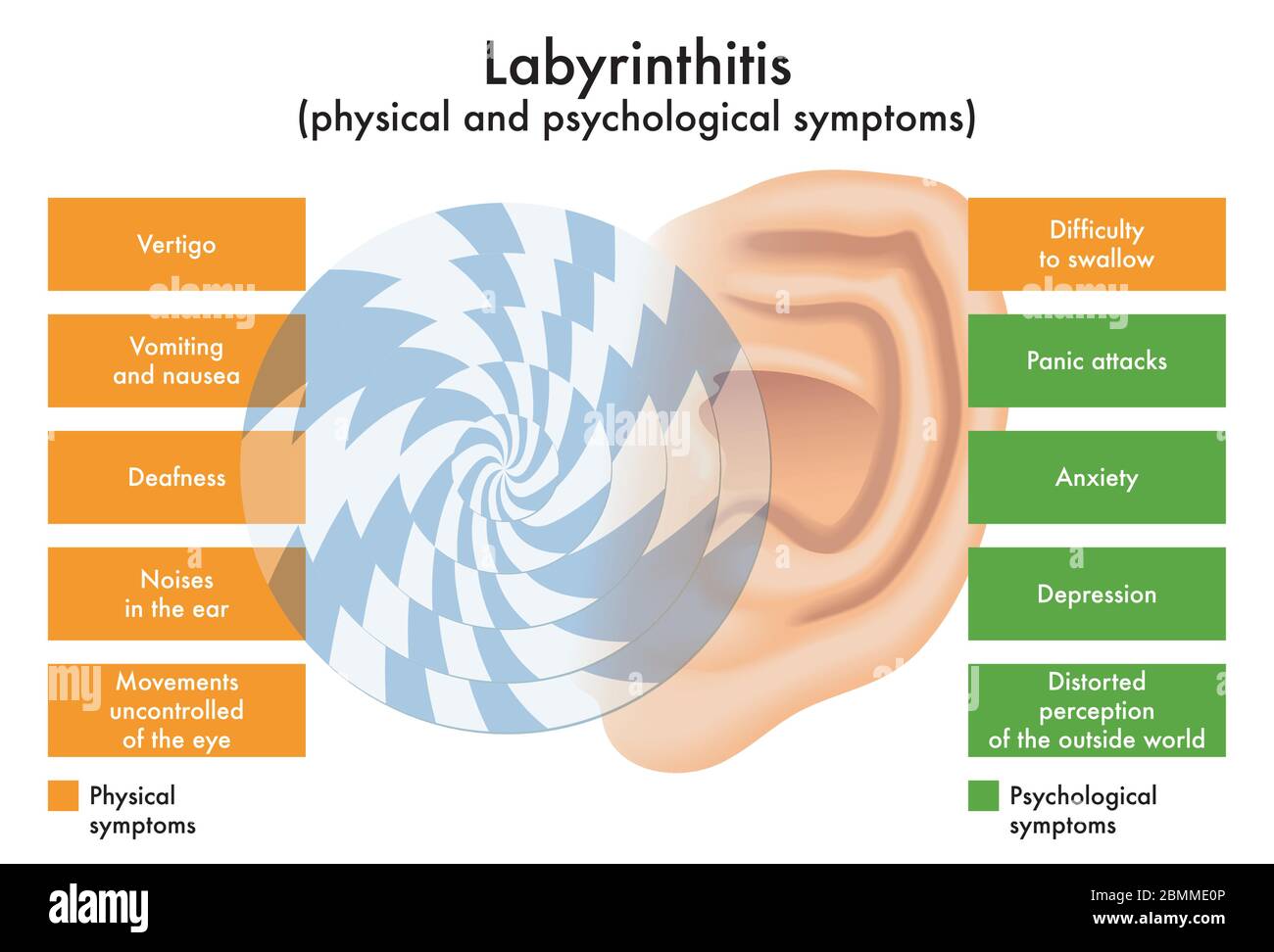 An illustrated diagram of physical and psychological symptoms of Labyrinthitis. Stock Vector