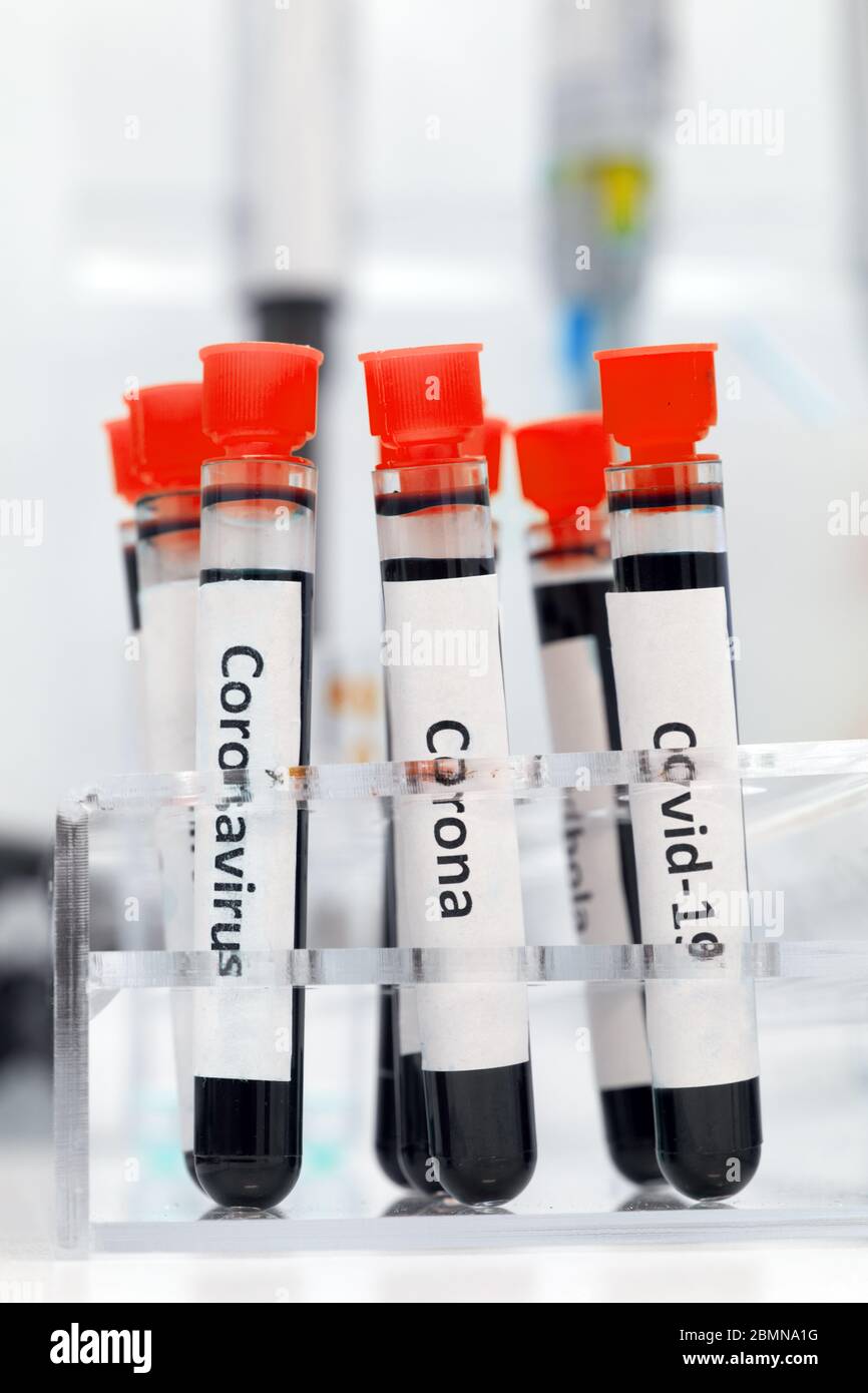 Research of virus in the lab. A test tubes with the inscription covid-19, coronavirus stands in a rack on a table in a laboratory. Samples with blood. Stock Photo
