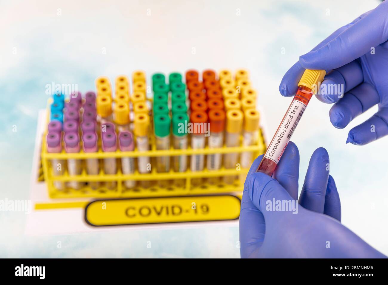 Lab worker preparing test blood for detection of antibodies and ...