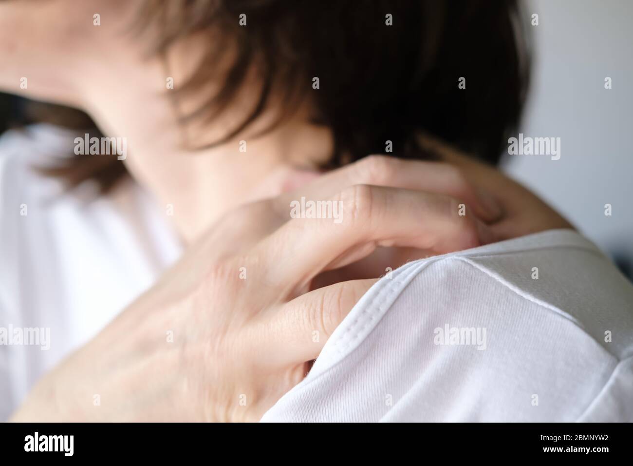 Female hand scratch itchy skin on his shoulder. Stock Photo