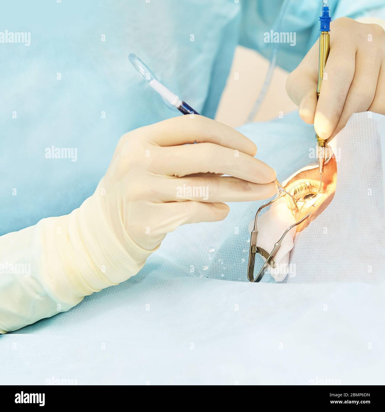 Ophthalmology laser microscope operation. Doctor in clinic. Patient treatment Stock Photo Alamy