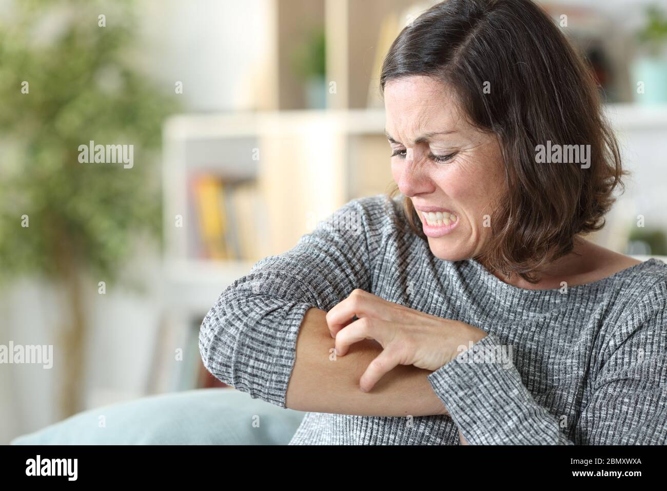 Skin Rash Woman High Resolution Stock Photography and Images Alamy