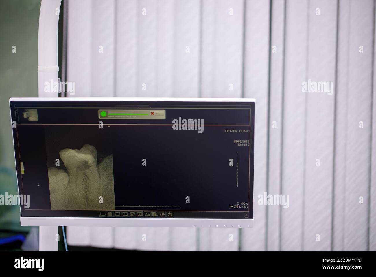 Dental xray on computer screen, isolated dentist office. Xrays that