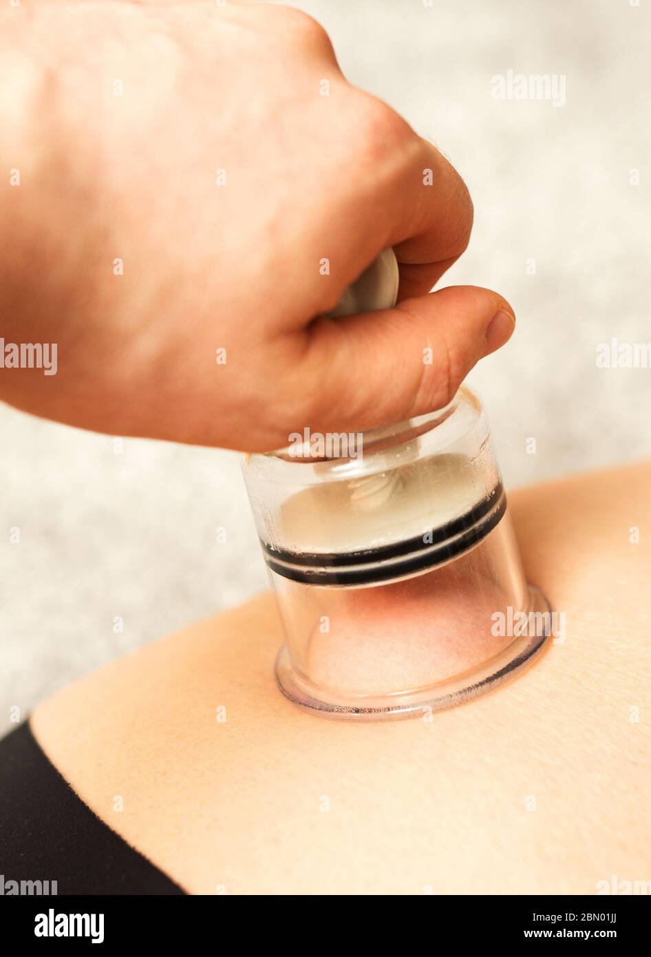 Anti-cellulite massage with a vacuum jar. Medical procedure. Stock Photo
