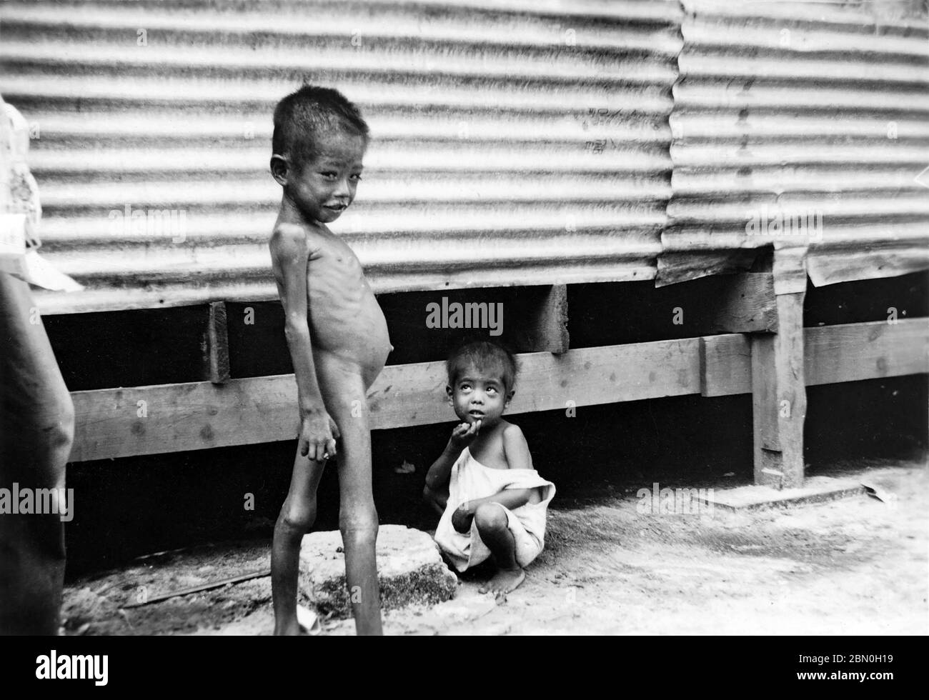 [ 1945 Japan - WWII Internment Camp, Saipan ] —   An underfed boy at WWII Susupe Internment Camp (ススッペキャンプ) in Saipan, ca. 1945 (Showa 20).  The camp was opened in 1944 (Showa 19) to house 13.000 Japanese civilians and 5.000 Chamorros, Kakanas and Koreans. It was closed on July 4, 1946 (Showa 21).  The US capture of the Northern Marianas in July 1944 resulted in the first US occupation of Japanese territory.  20th century gelatin silver print. Stock Photo