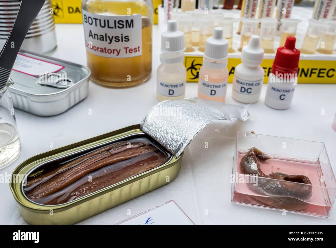 Canned food can contaminated by Clostridium botulinum toxin that causes