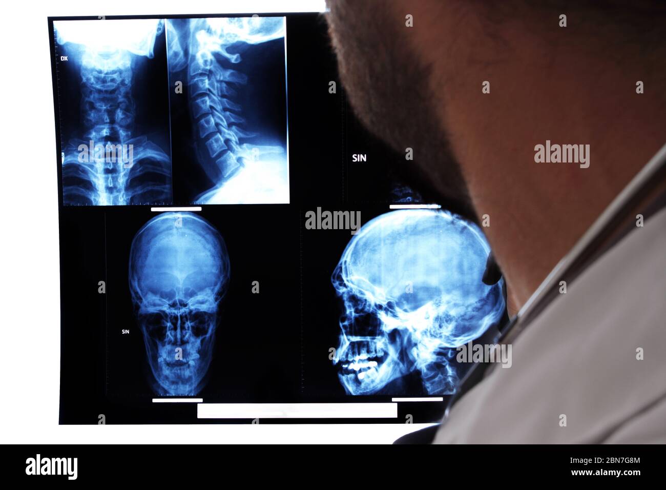 the doctor looks at MRI Stock Photo