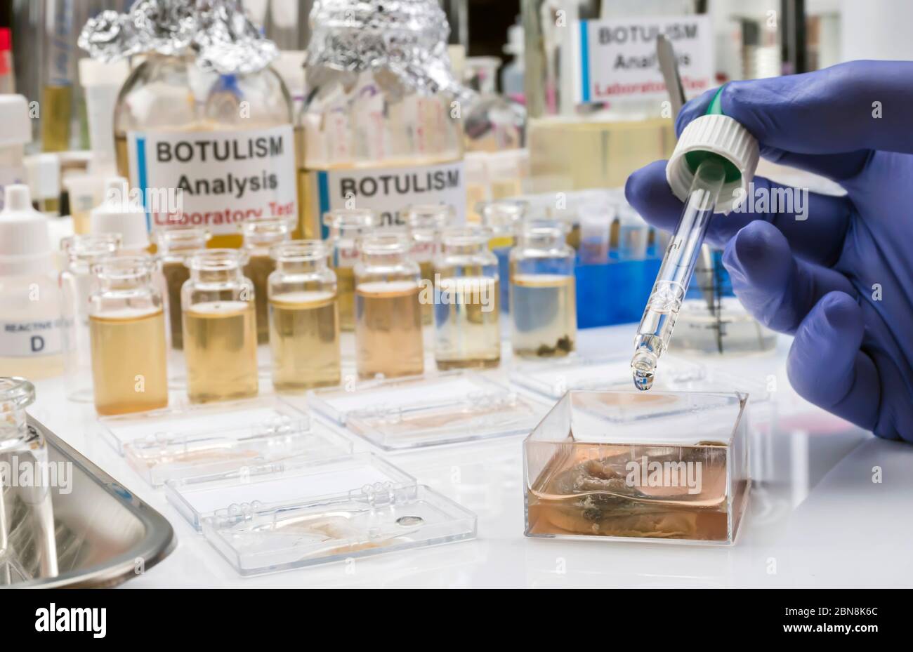 Canned food can contaminated by Clostridium botulinum toxin that causes