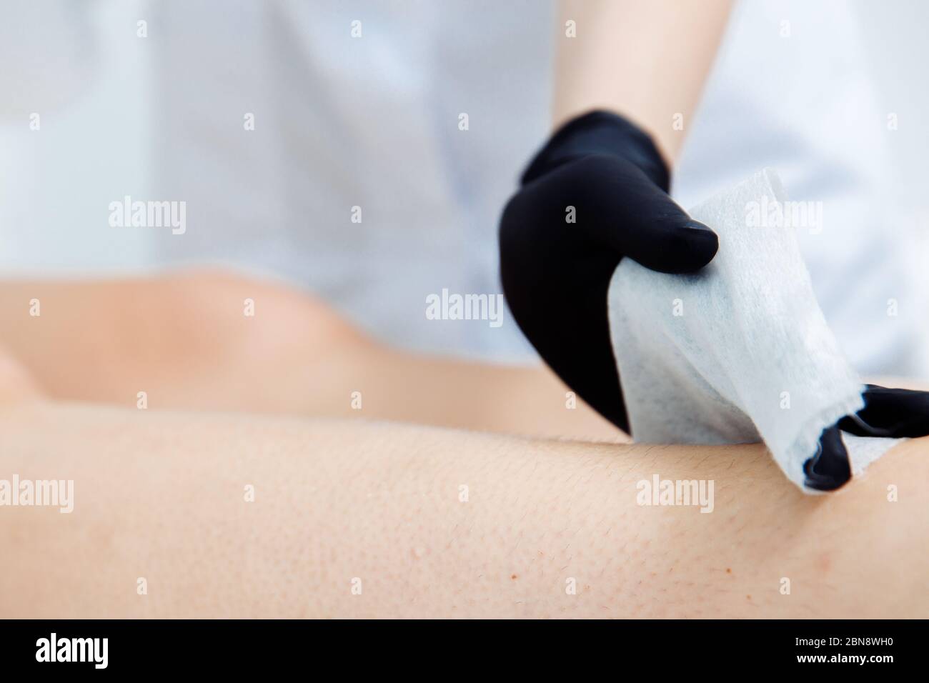 How to do waxing. Womens DIY. Step 3 of 8 Disinfect the surface from which the hair will be removed. Stock Photo