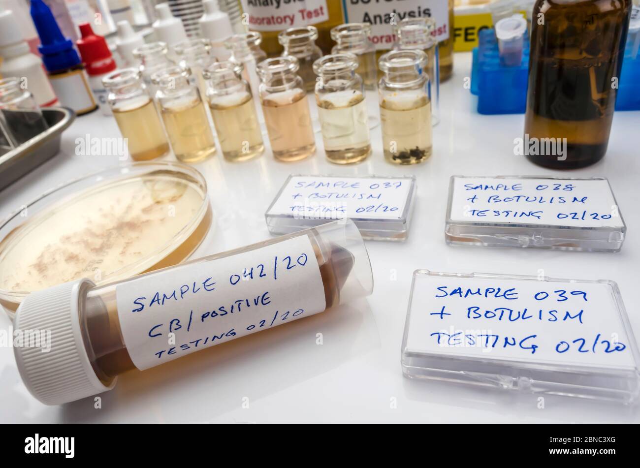 Samples contaminated by Clostridium botulinum toxin that causes botulism in humans, laboratory research, conceptual image Stock Photo