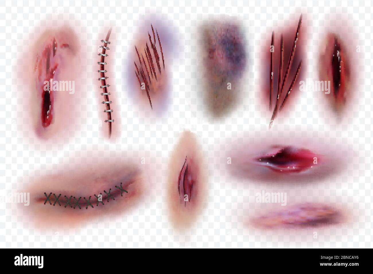 Realistic scars. Wound, surgical stitches and bruis, skin cuts. Bloody