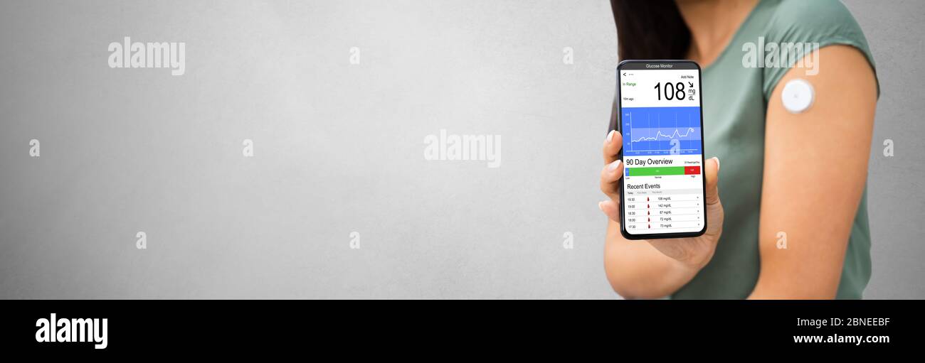Glucose Continuous Sugar Check Smart Monitor For Diabetes Patient Stock Photo Alamy