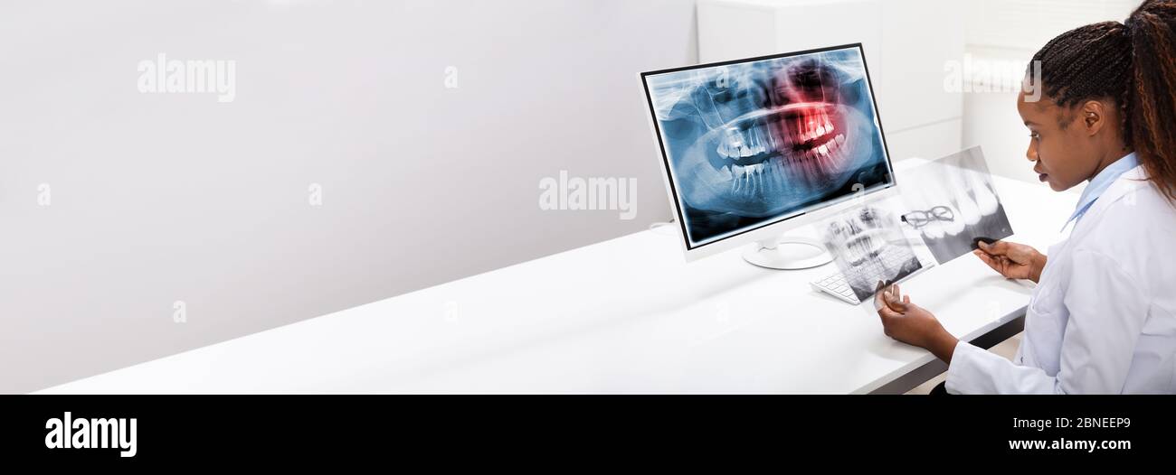 Dentist Doctor Using Computer Technology For Teeth X Ray Stock Photo
