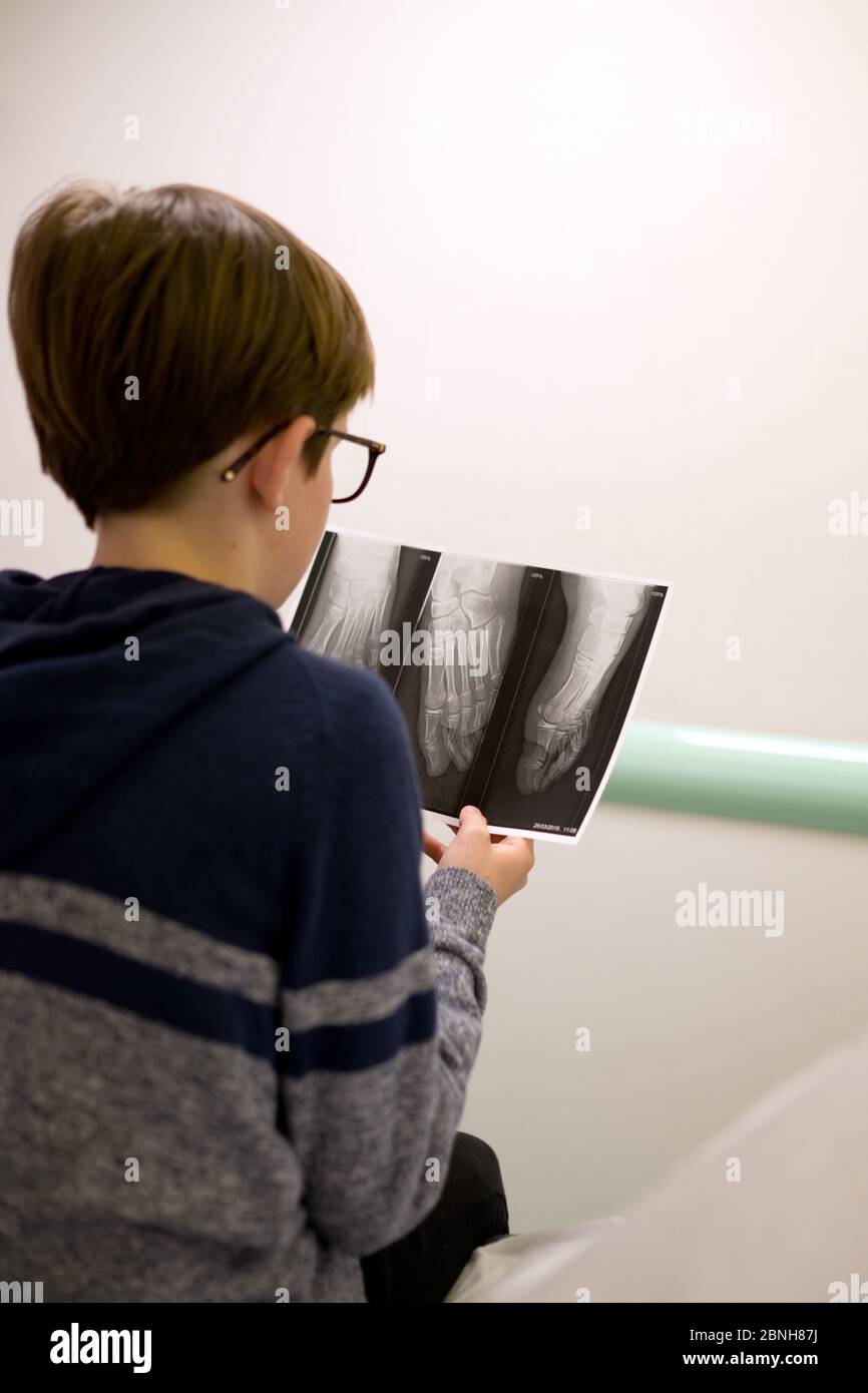 looking over the shoulder of a twelve year old boy who is looking at an X-ray in his hand of his foot with a fractured toe Stock Photo