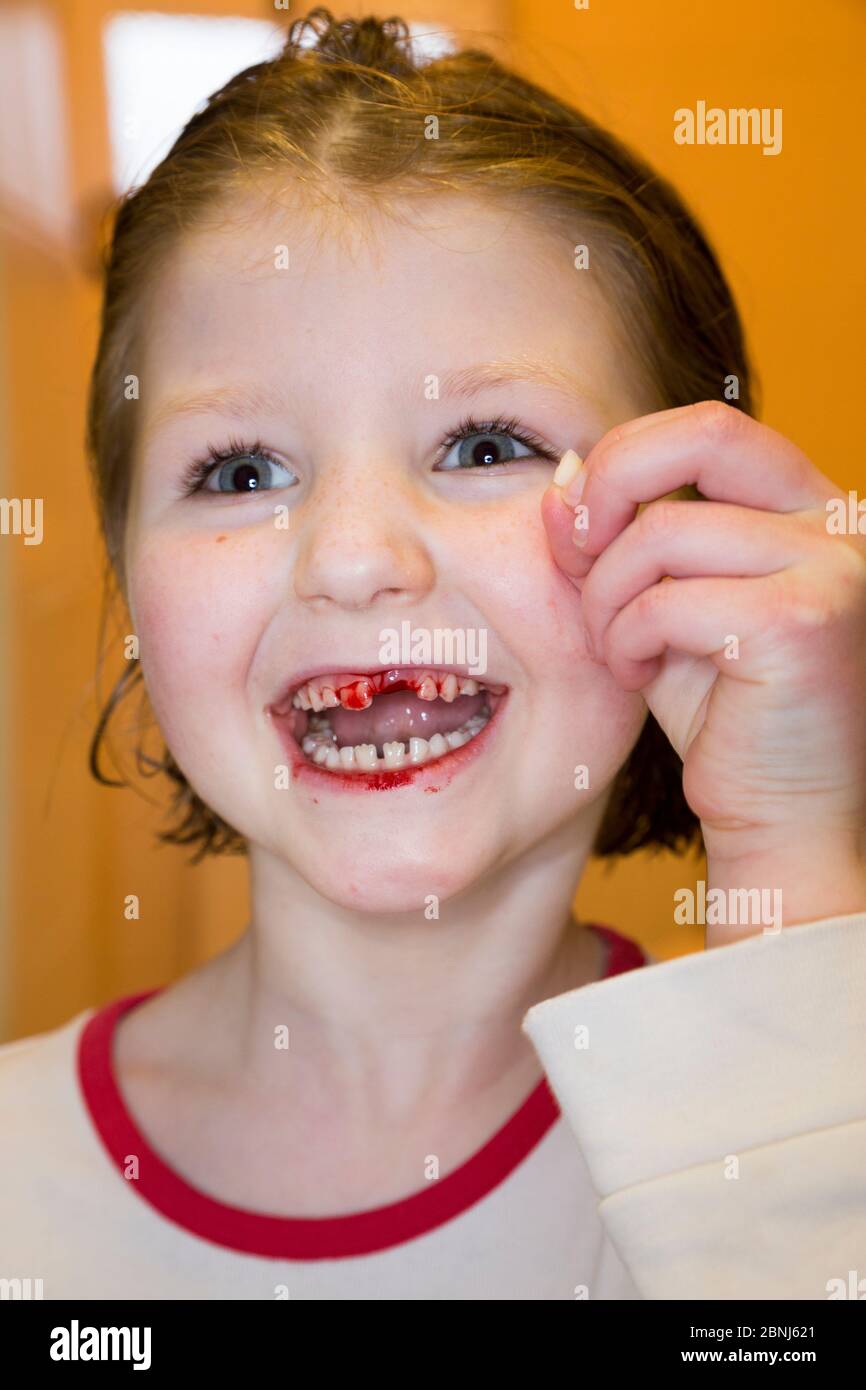A childs kids childrens gappy teeth hires stock photography and images