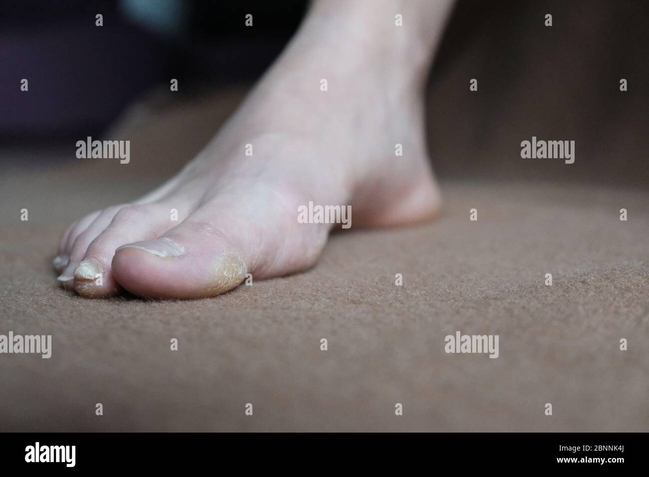 Plump Toes