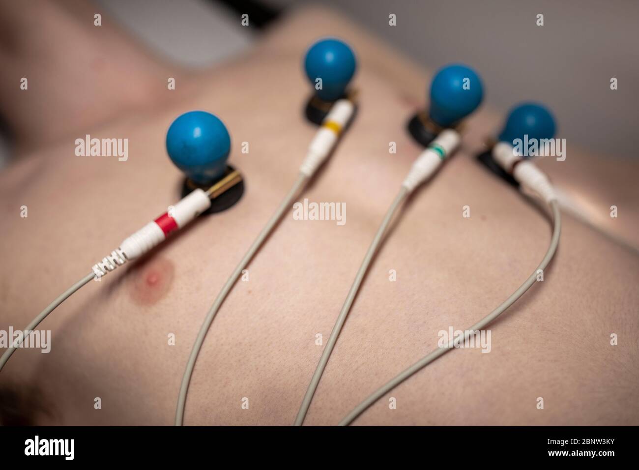 A patient with EKG electrodes attached to his body Stock Photo Alamy