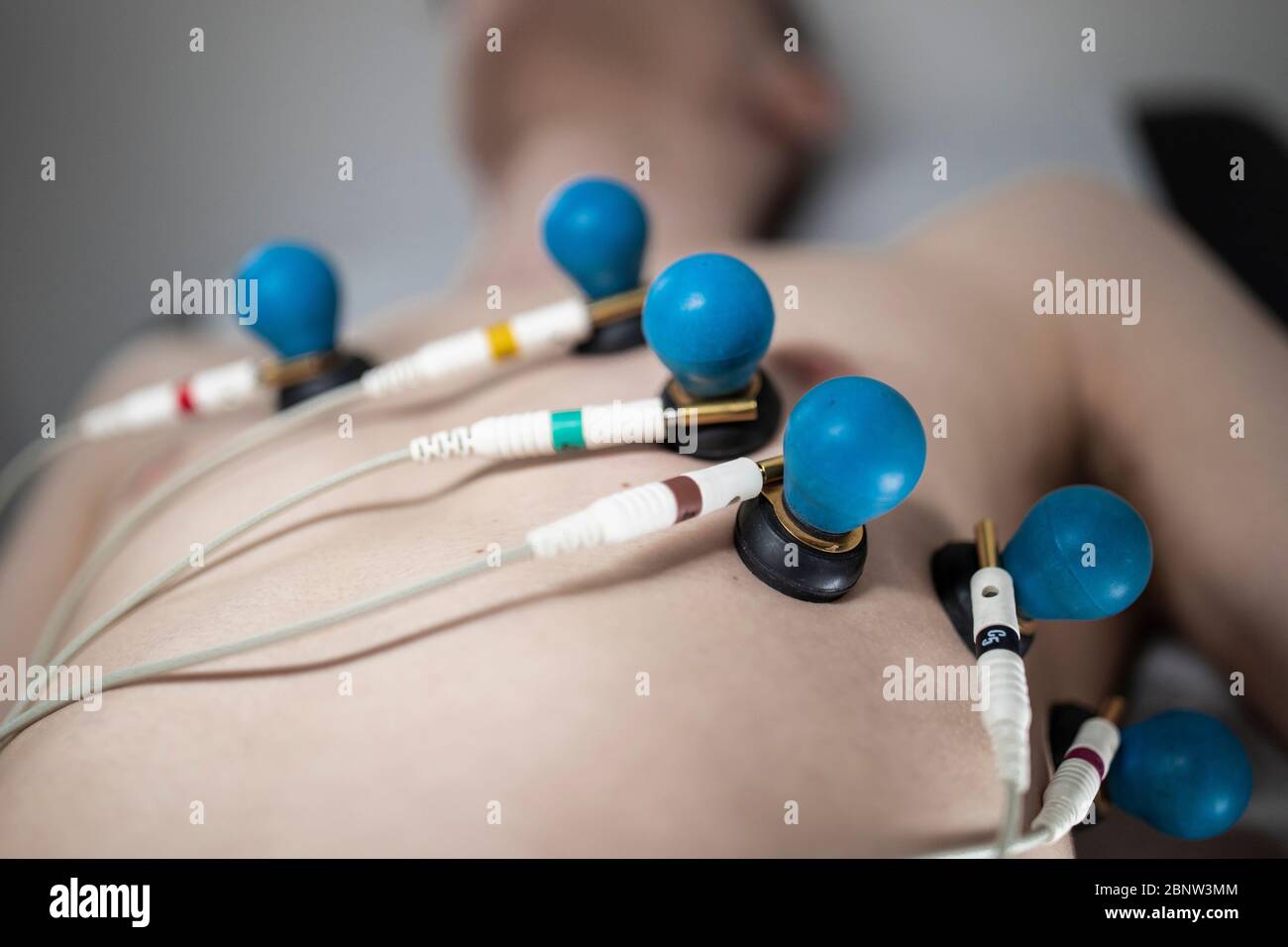 A patient with EKG electrodes attached to his body. Stock Photo