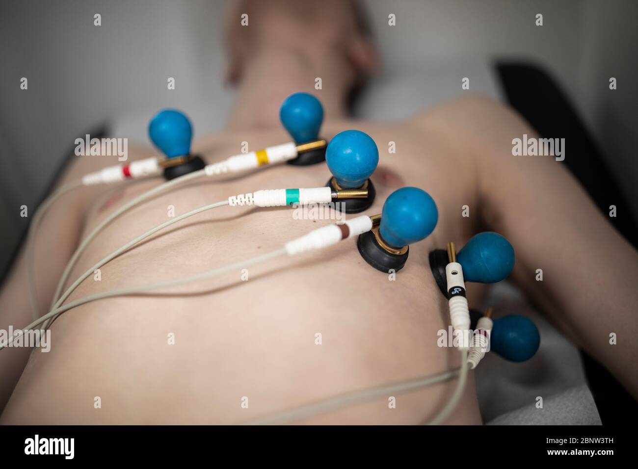 A patient with EKG electrodes attached to his body Stock Photo Alamy
