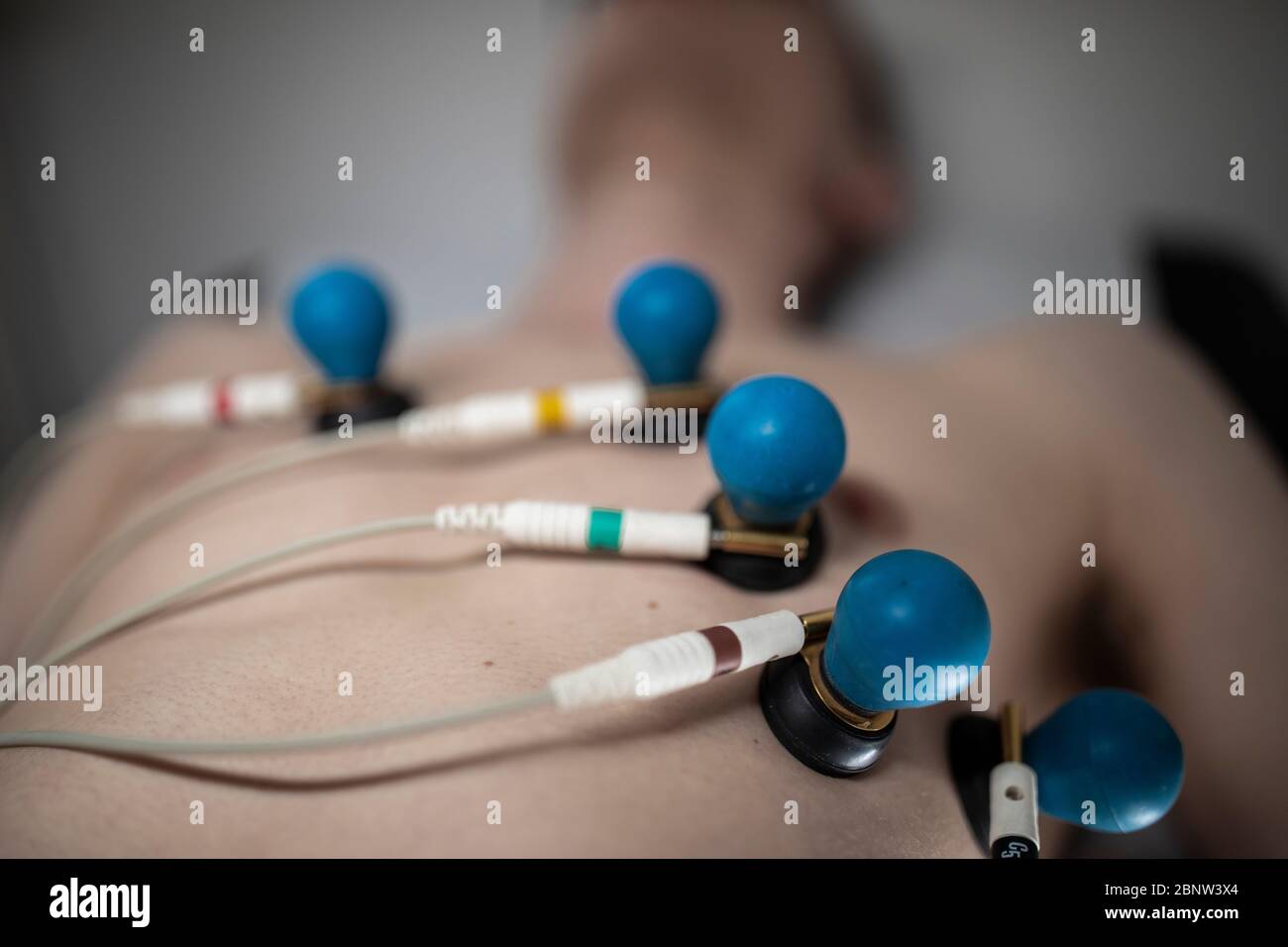 A patient with EKG electrodes attached to his body Stock Photo Alamy