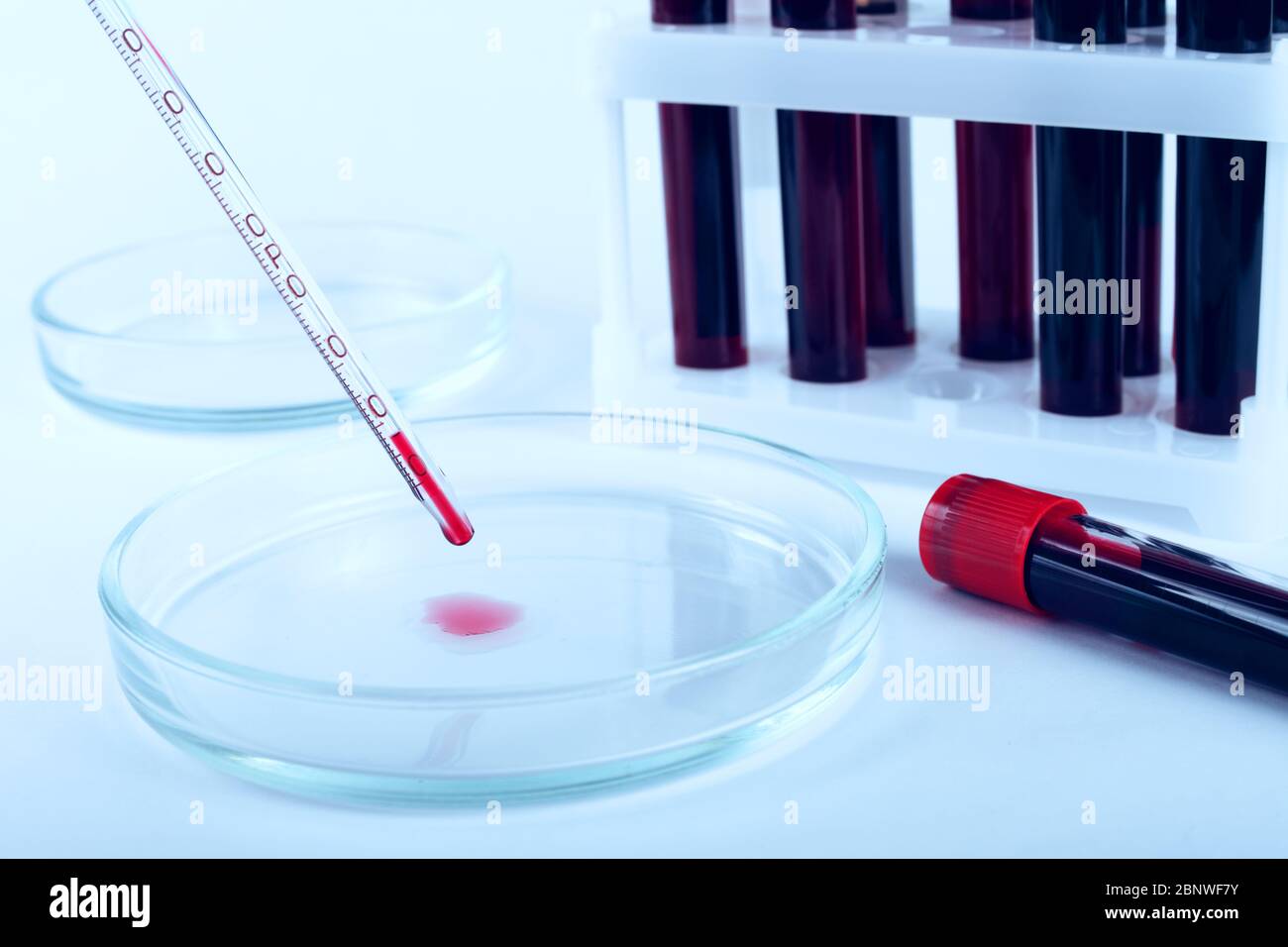 petri dish and glass dropper on a laboratory bench, toned blue color ...