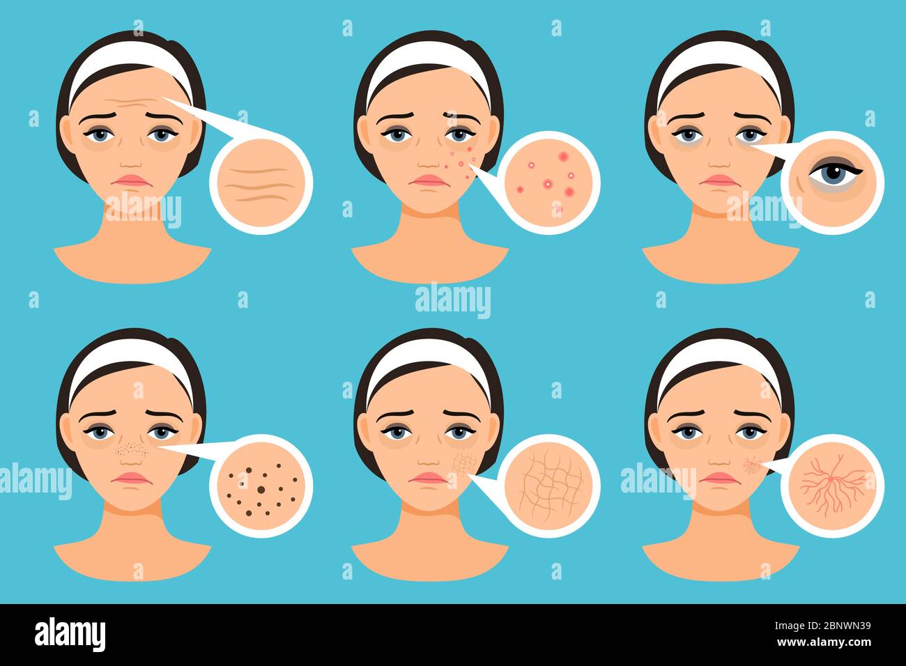 Female face with skin problems vector illustration. Woman with problem areas Stock Vector Image