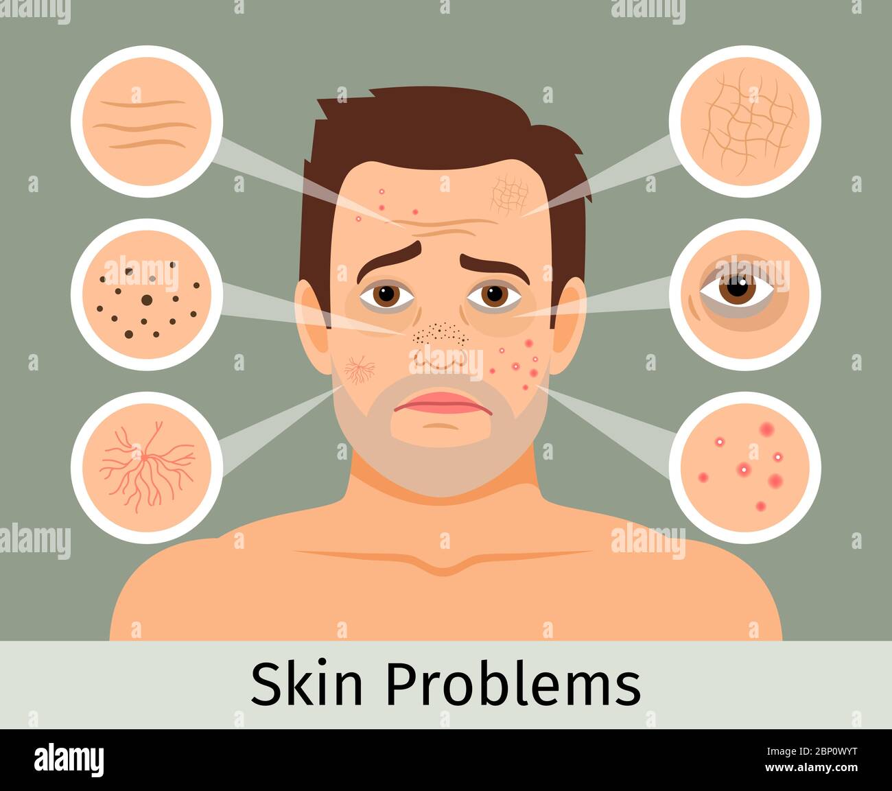 Male facial skin problems vector illustration. Acne and dark spots, wrinkles and circles under the eyes for cosmetics websites Stock Vector