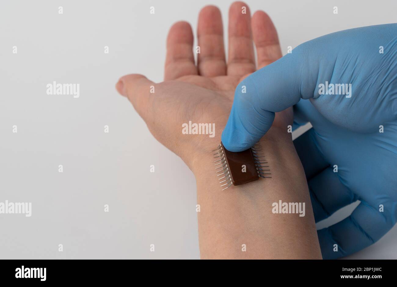 Microchip implant human hires stock photography and images Alamy