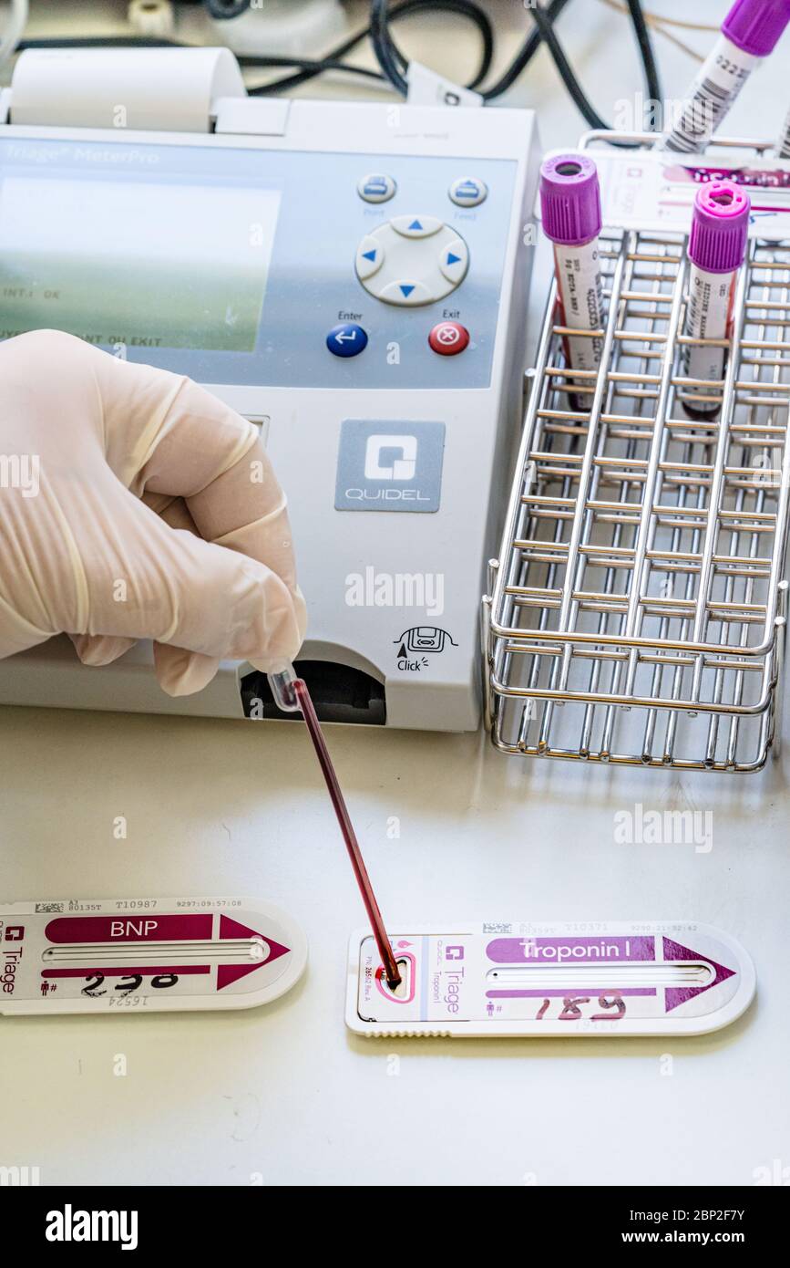 Troponin, prescribed blood test if myocardial infarction is suspected