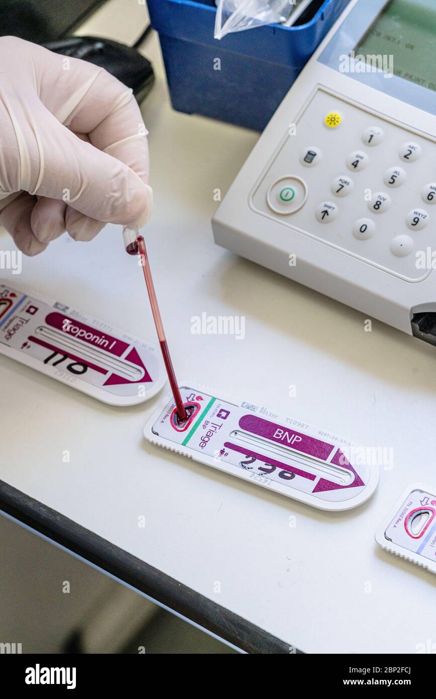 Troponin, prescribed blood test if myocardial infarction is suspected