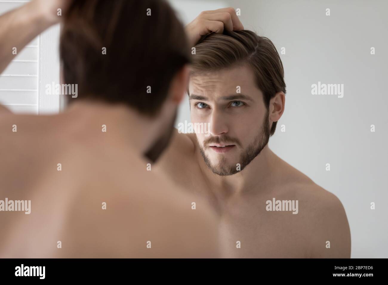Anxious young man worried about hair loss or receding hairline Stock Photo