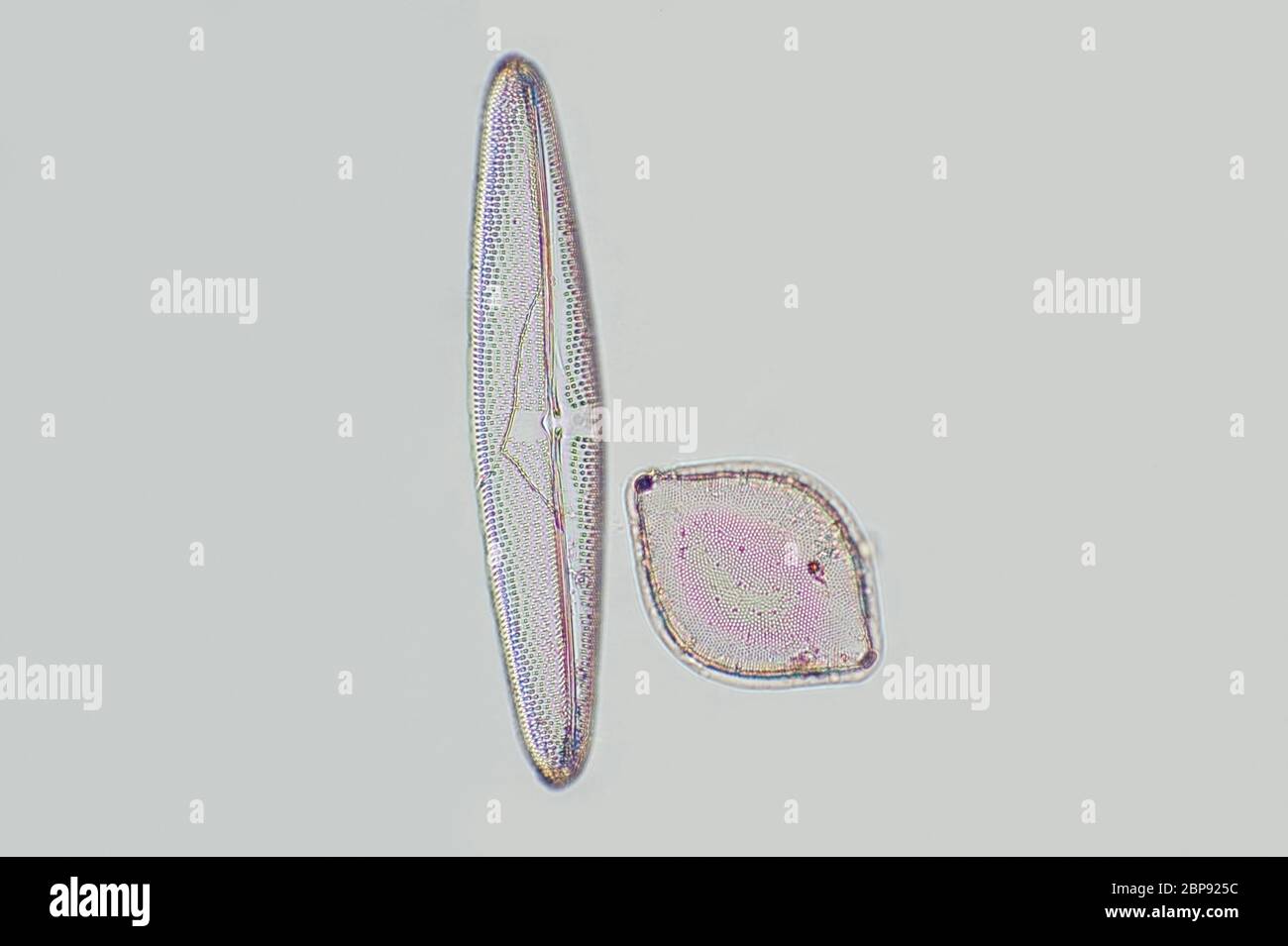 Diatom, microscope view Stock Photo