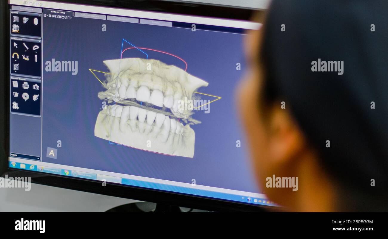 Dentist analyzing a 3d image Stock Photo
