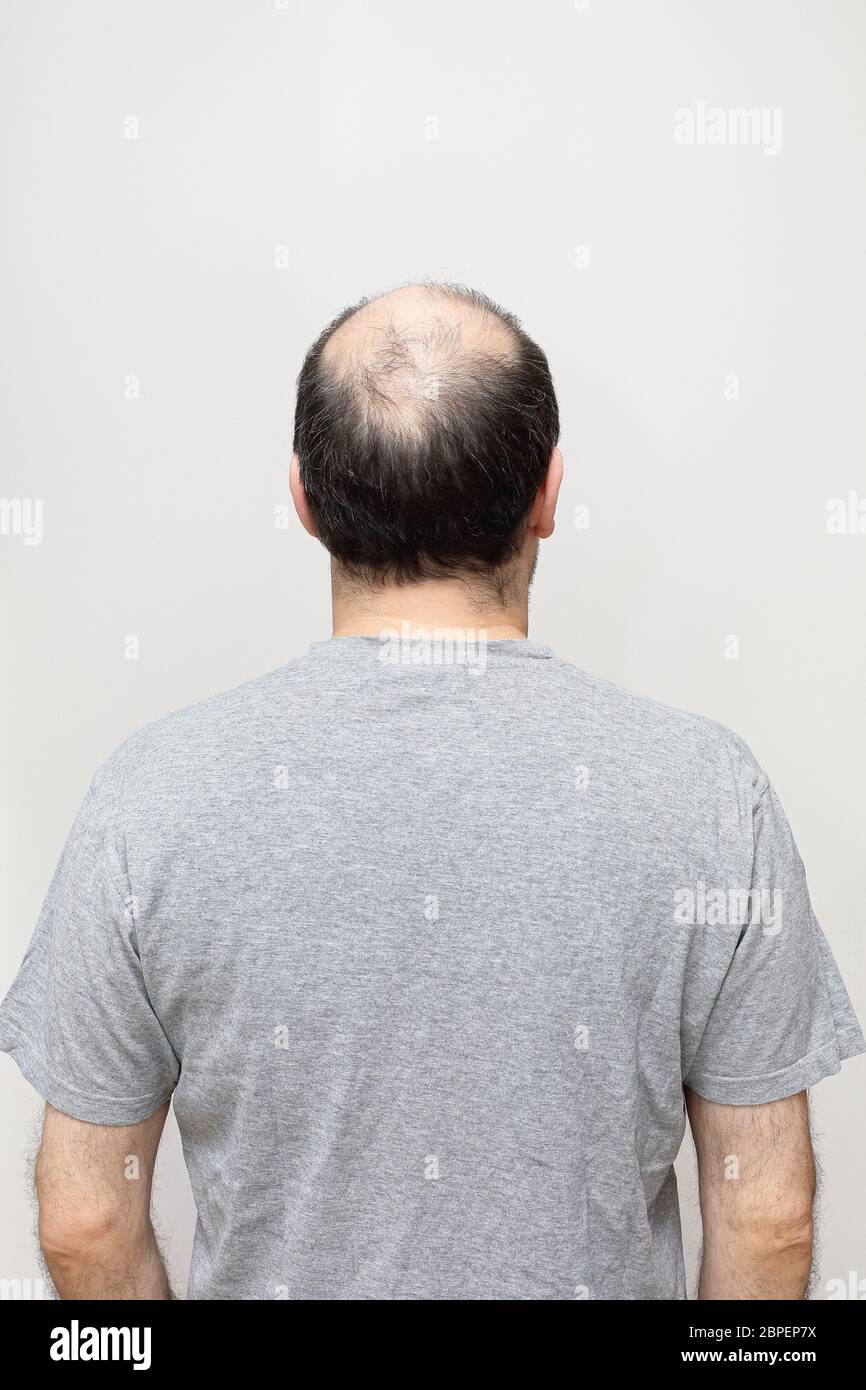 Male rear view hair hi-res stock photography and images - Alamy