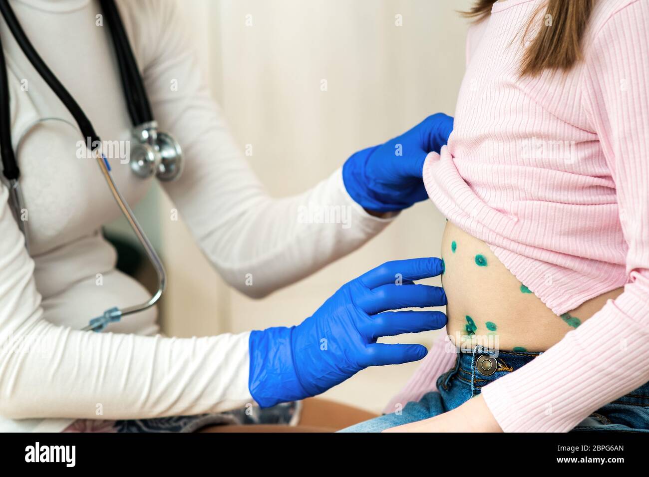 Doctor examining a child covered with green rashes on stomach ill with chickenpox, measles or rubella virus. Stock Photo