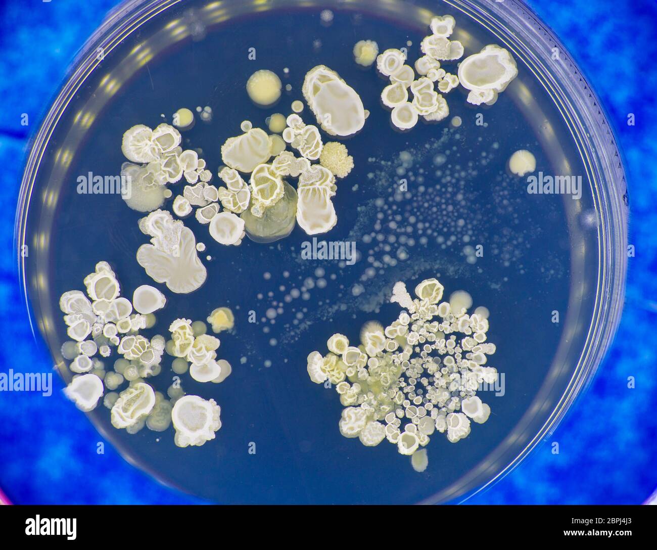 Tests for skin fungal diseases. Samples of fungus causing skin diseases grown in a petri dish Stock Photo