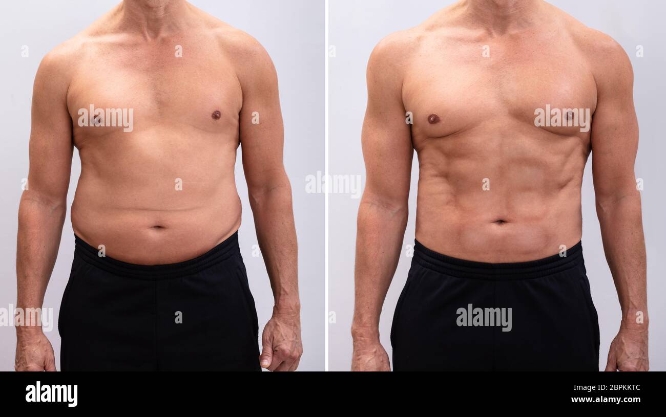 Man before and after weight loss hi-res stock photography and images - Alamy