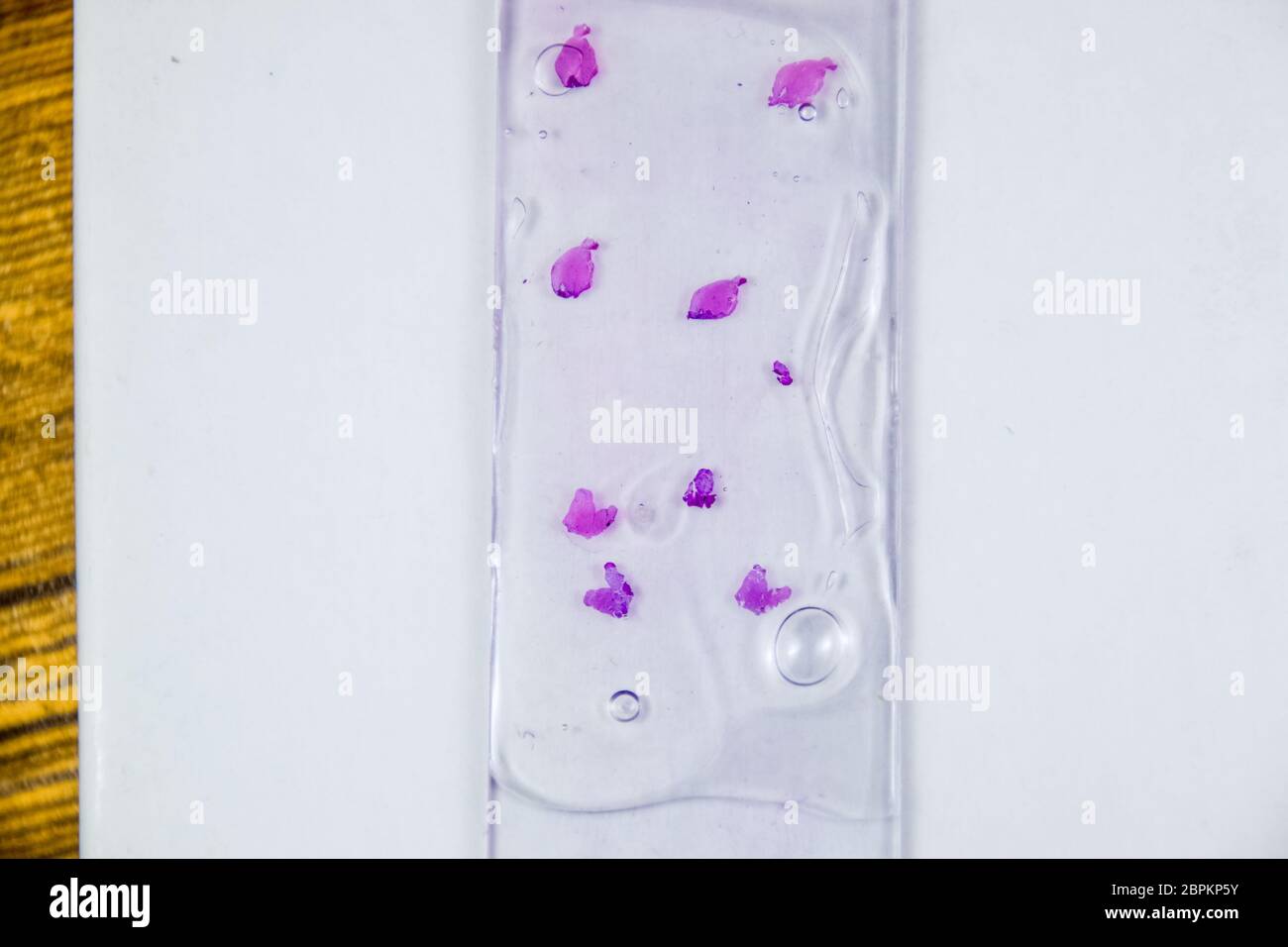 Slices of the tumor under glass. Histological examination of tumor cells for the presence of cancer. Samples of tumor cells under the sleek against th Stock Photo