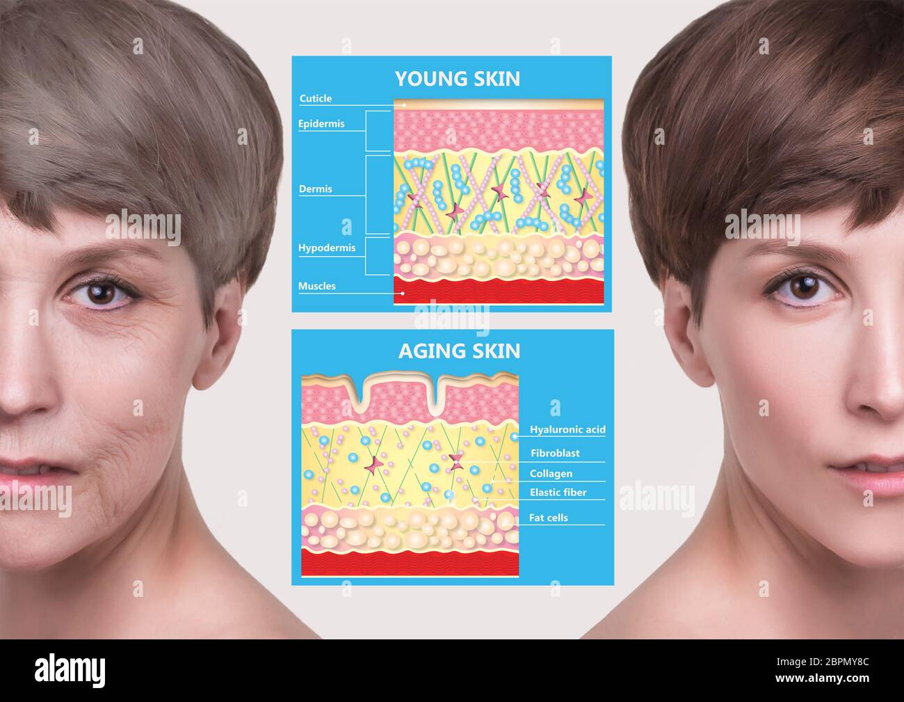 The younger skin and aging skin. elastin and collagen. A diagram of