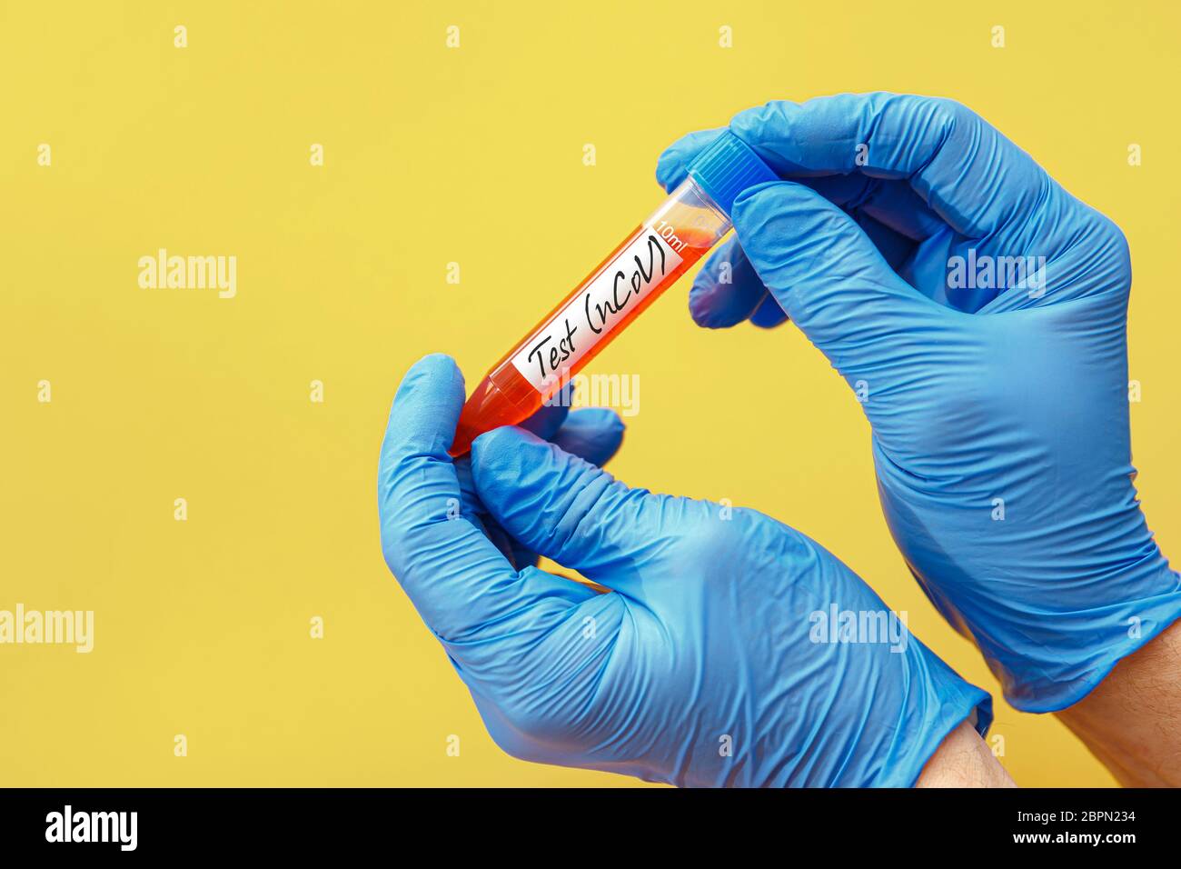 Test tube with blood sample for COVID-19 test, novel coronavirus 2019 Stock Photo