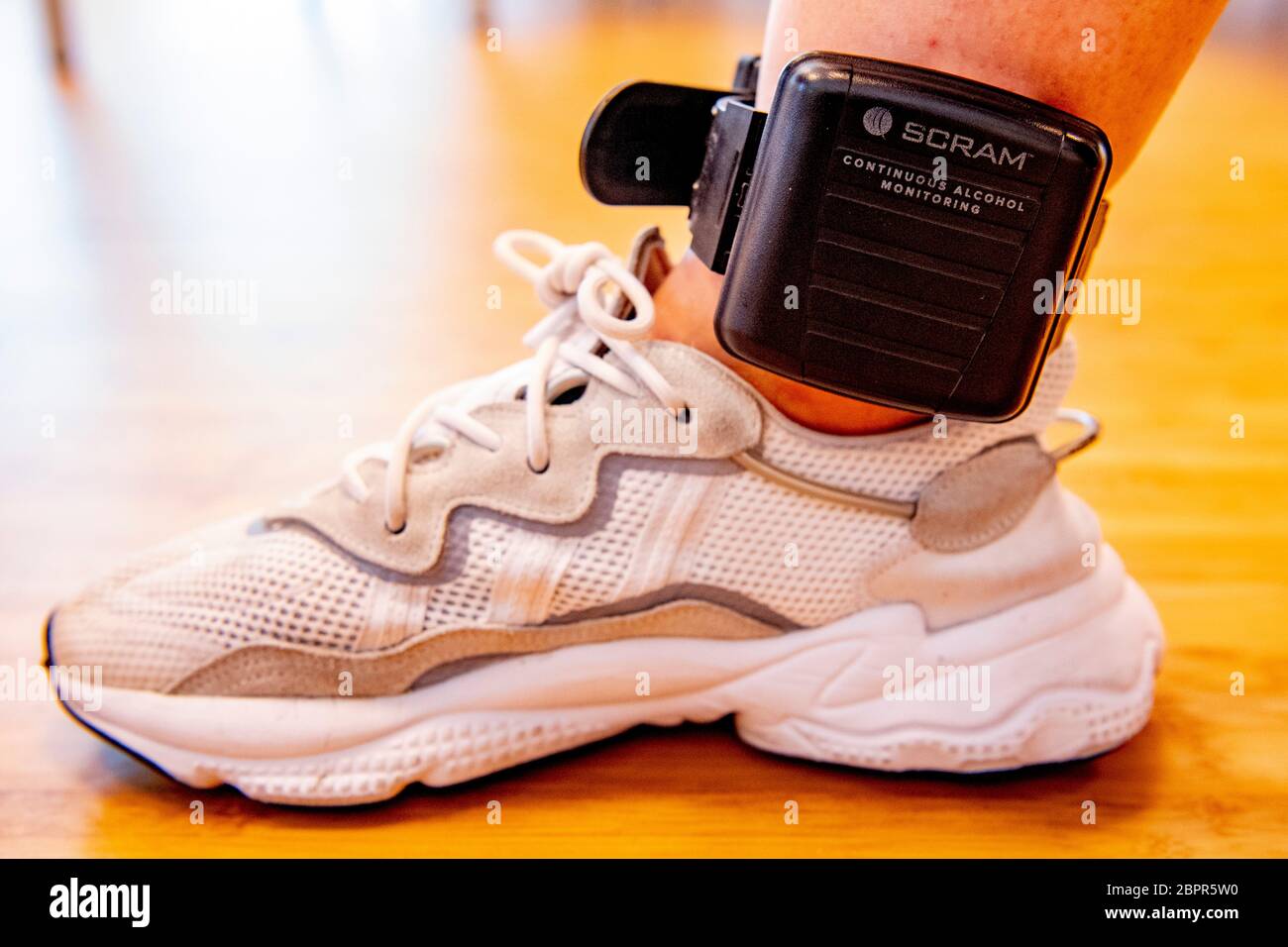 The alcoholmeter, an ankle strap that measures alcohol consumption