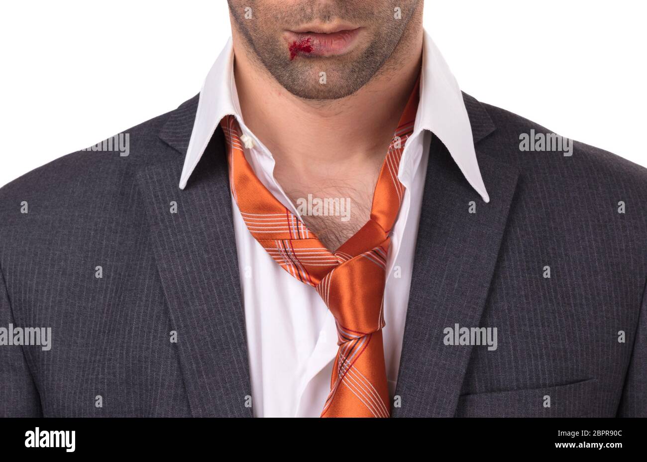 bleeding blood bloody caucasian hires stock photography and images alamy 