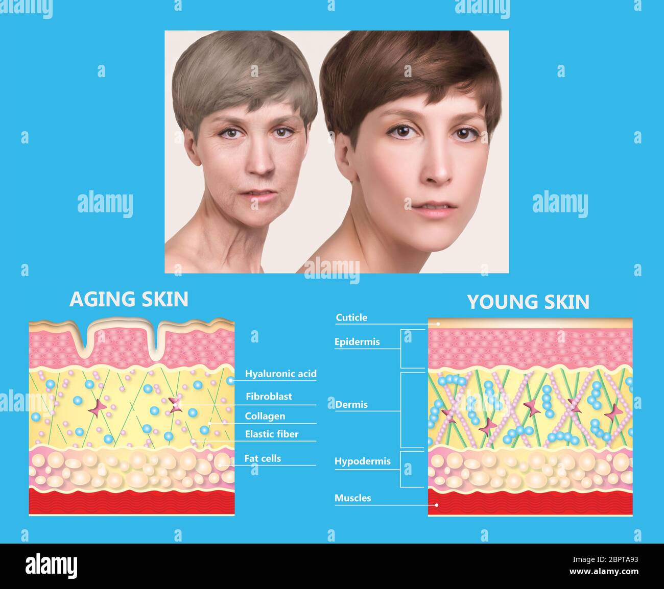 The diagram of younger skin and aging skin showing the decrease in 