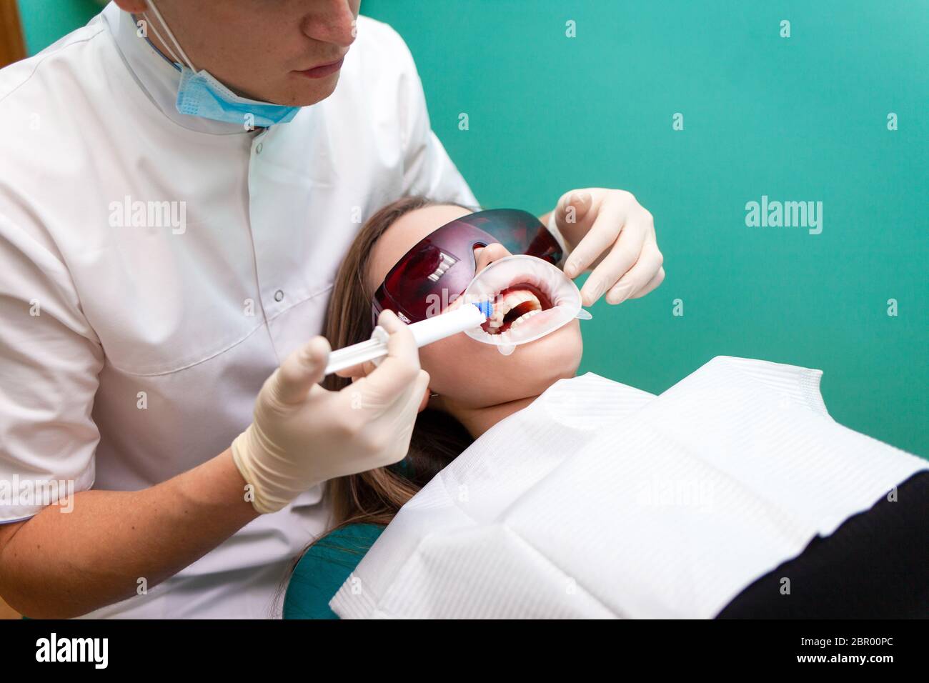 Dentist applies a tooth whitening gel with a syringe. Girl undergoes a