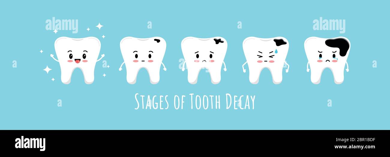 Stages of emoji tooth decay icon set. Cute kawaii teeth on different stages of dental caries development. Flat cartoon emoji character vector illustra Stock Vector