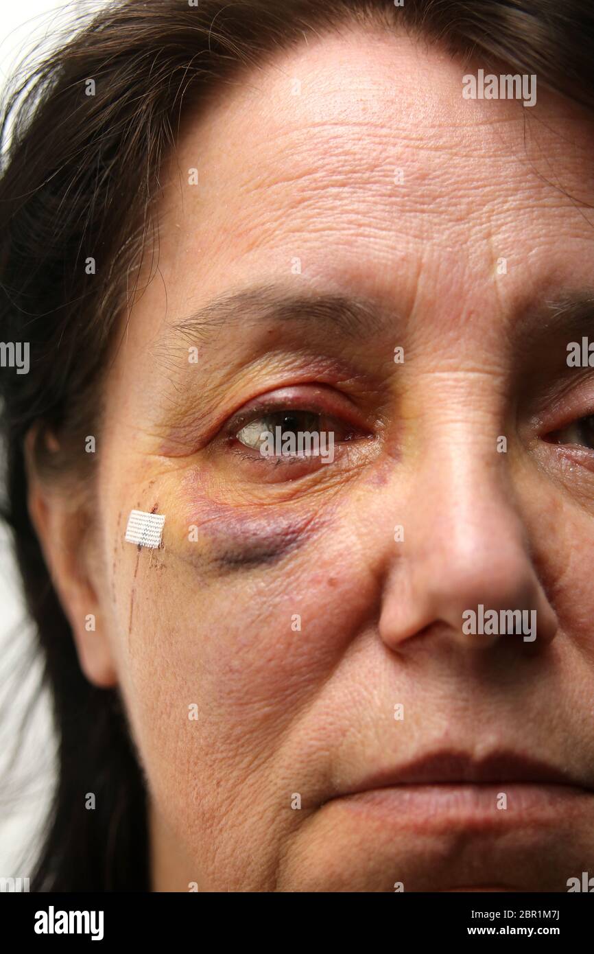 Häusliche Gewalt Stock Photo